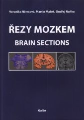 Řezy mozkem =Brain sections : atlas makroskopických, mikroskopických a MRI řezů = atlas of macroscopic, microscopic and MRI sections