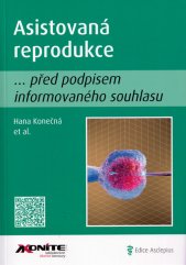 Asistovaná reprodukce :... před podpisem informovaného souhlasu