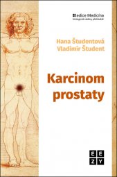 Karcinom prostaty :současné možnosti diagnostiky a léčby